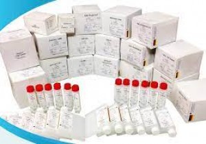 THÔNG BÁO 2065/TB-BV VỀ VIỆC MỜI CHÀO GIÁ CÁC MẶT HÀNG HÓA CHẤT XÉT NGHIỆM